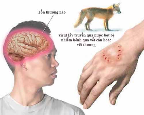 Chó dại đáng sợ, nhưng chúng ta vẫn có thể chăm sóc chúng một cách an toàn. Xem hình ảnh liên quan để biết cách tiêm phòng và giúp chó tránh được bệnh dại.
